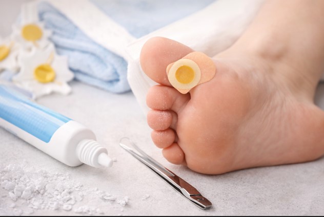 Moisturizing feet and using proper footwear to prevent corns and calluses